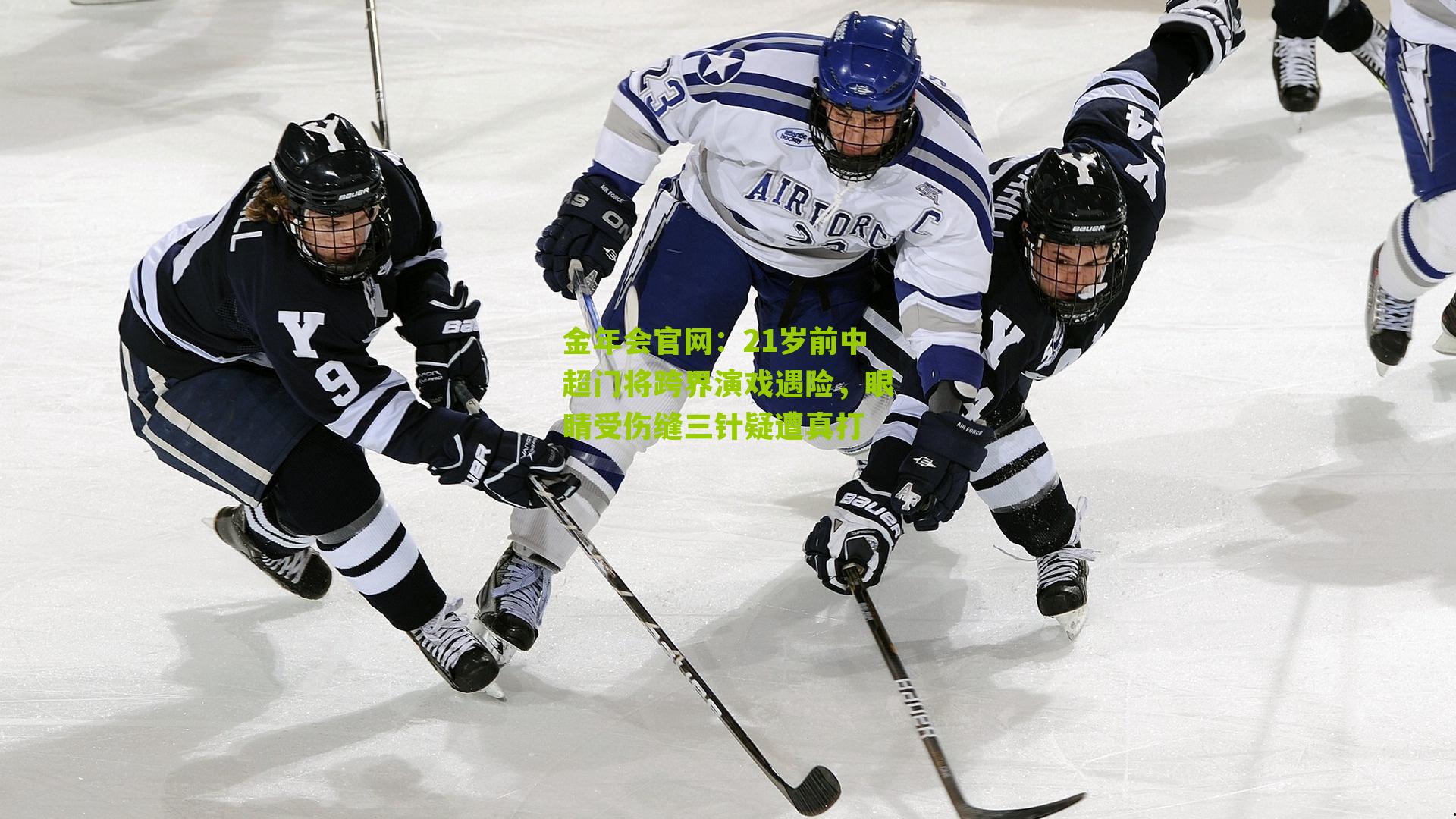 金年会官网：21岁前中超门将跨界演戏遇险，眼睛受伤缝三针疑遭真打